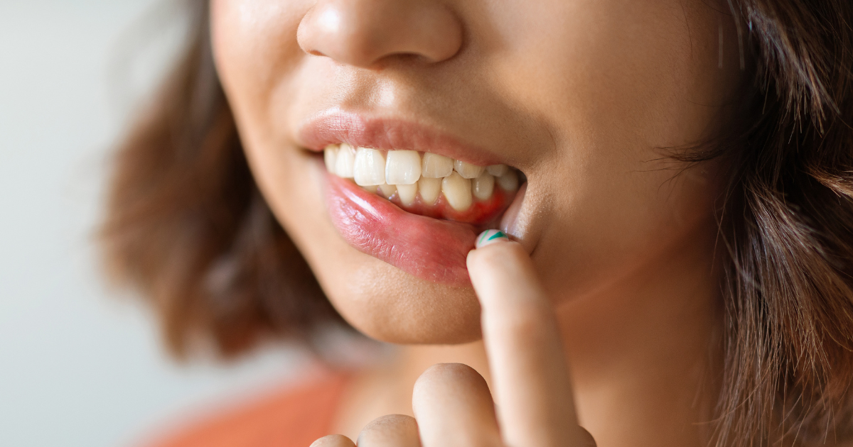 Early-Signs-Of-Gum-Disease-You-Should-Never-Ignore