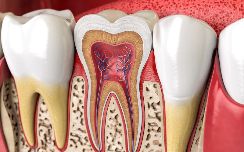 Emergency Root Canal Solutions