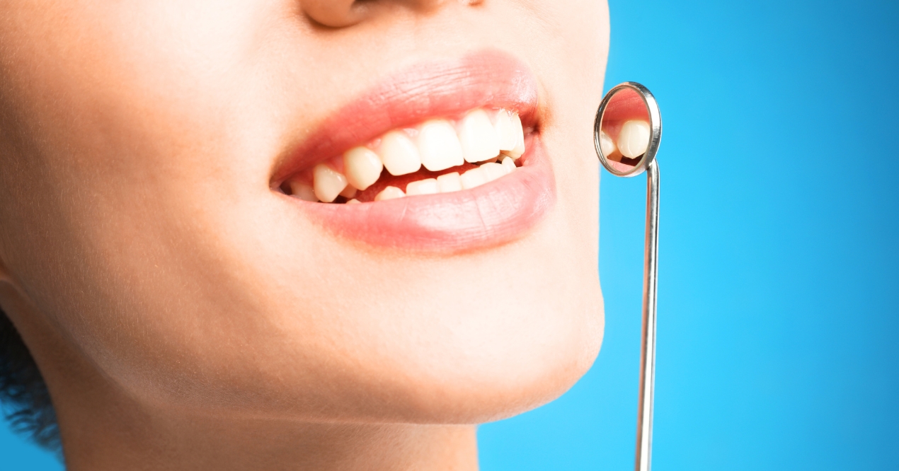 The Power of 4 Why Cosmetic Dentistry Wins