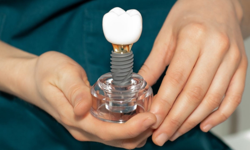 teeth grinding impact dental implant success
