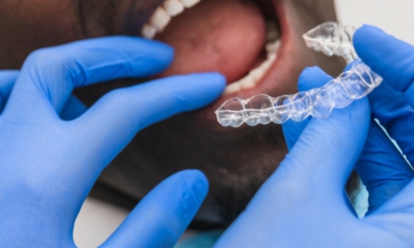 teen get invisalign before prom